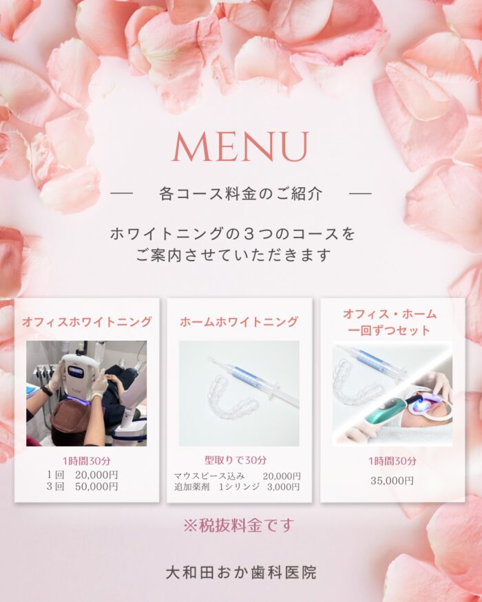 ホワイトニングの料金