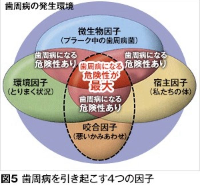 歯周病の因子