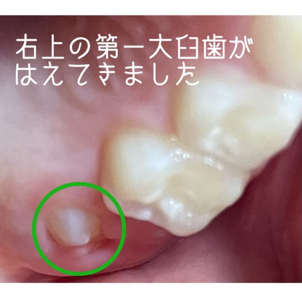 歯の生え変わり