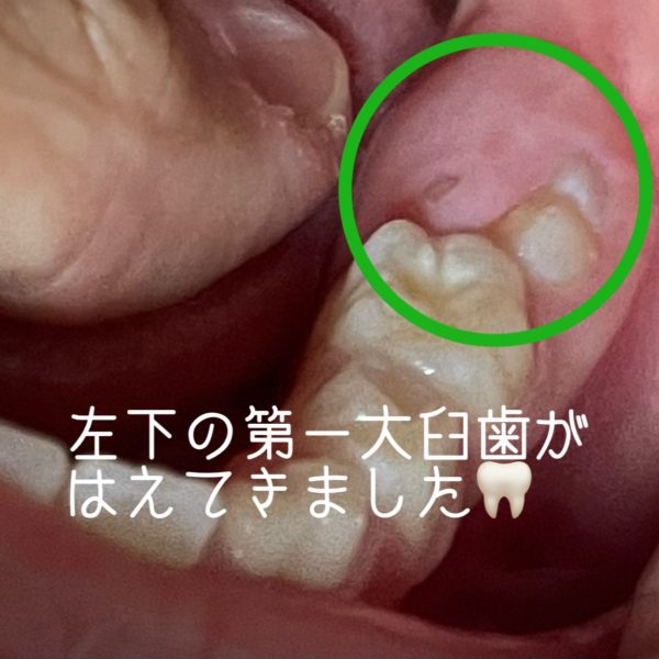 歯の生え変わり